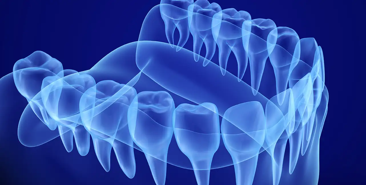 Restaurative Zahnmedizin